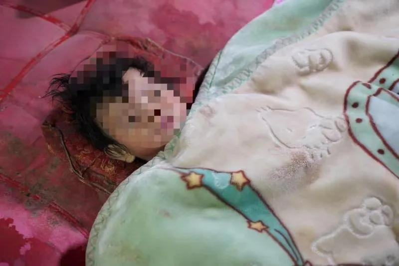 坠楼女婴或有后遗症,这件事情始末到底是如何?