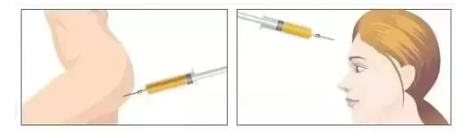 填充脂肪多少钱?