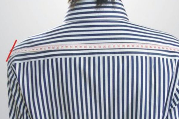 肩宽太宽怎么办