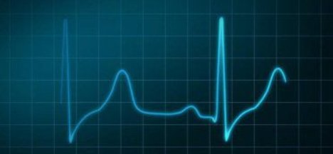 一毫安是多少安？