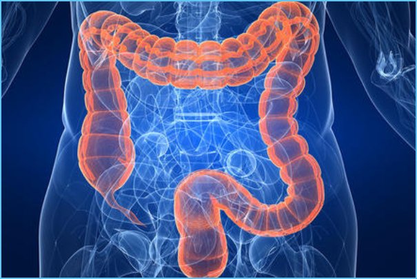 直肠癌早期症状