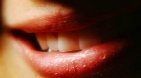 口角炎怎样治疗