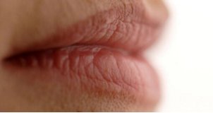 口角炎怎样治疗