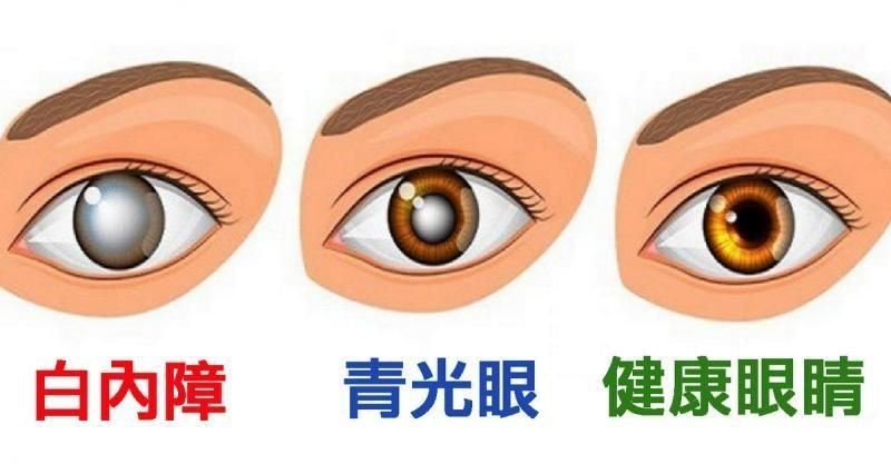 青光眼患者手术后应该怎样护理？