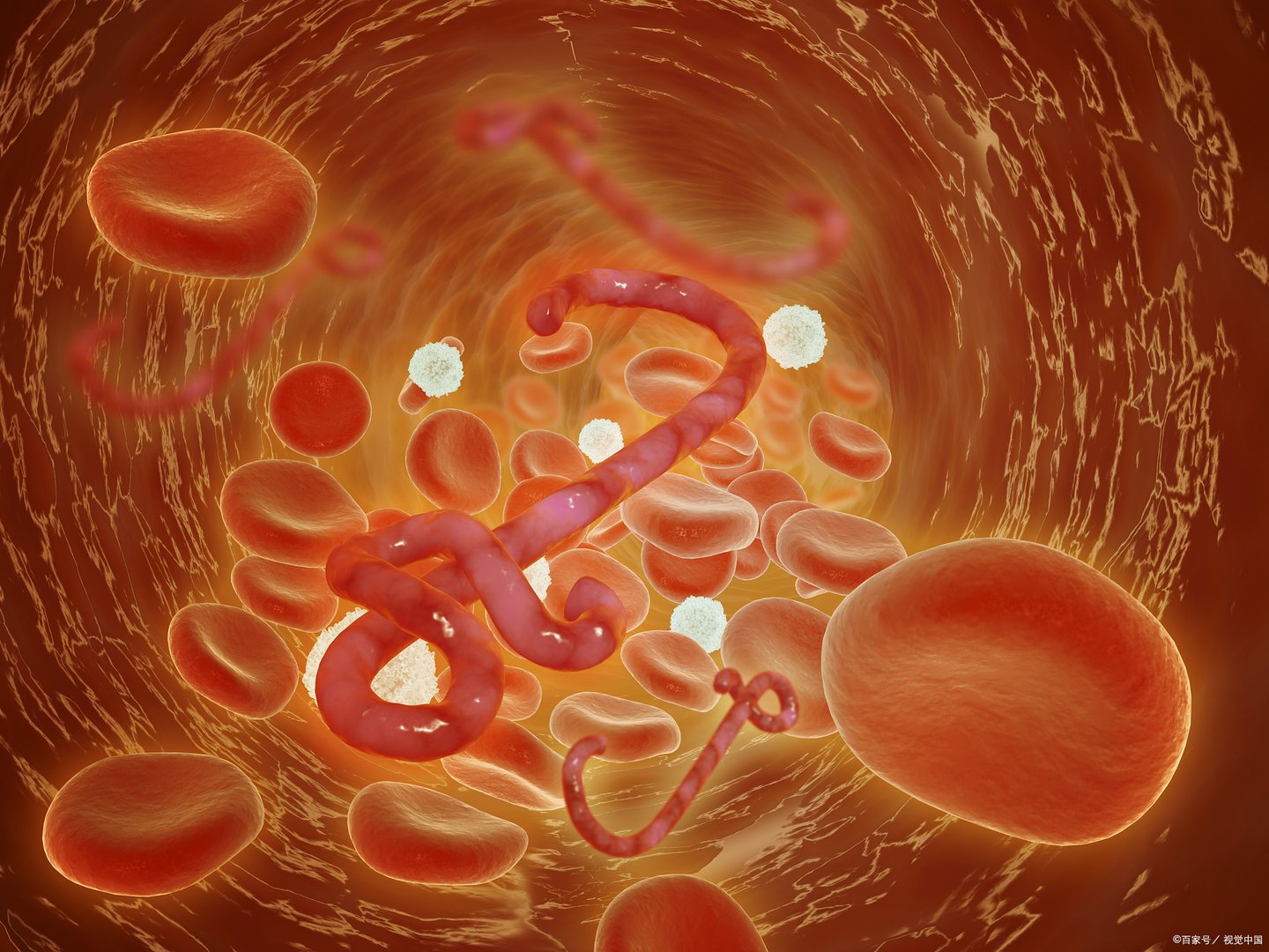 西安相继接诊多例出血热，该病症的死亡率有多高？