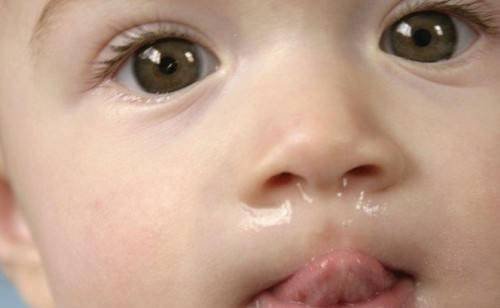 小孩流鼻涕怎么办