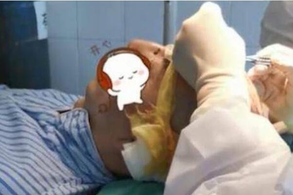 24岁小伙疯狂健身后险些秃头，肌肉和头发你选择拥有哪个？