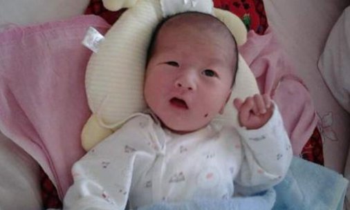 孩子的“胎记”是从何而来?