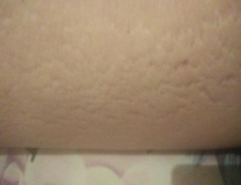 妊辰纹长什么样图片