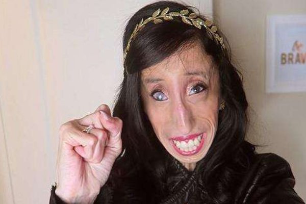 世上最瘦的人？