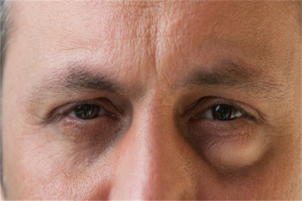 眼部按摩有什么好处？