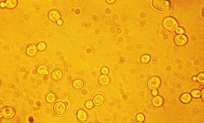 怎么培养酵母菌啊?_?