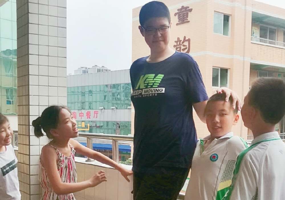 四川14岁男孩身高221厘米,这么高会对生活有影响吗?