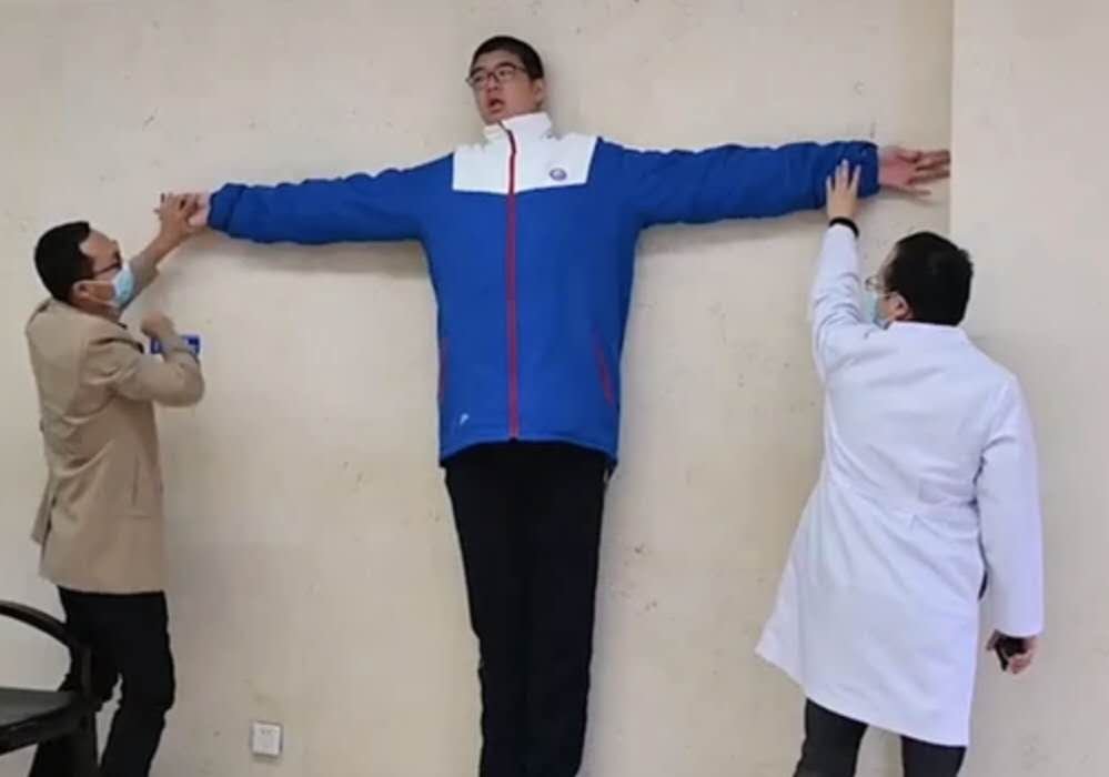 四川14岁男孩身高221厘米,这么高会对生活有影响吗?