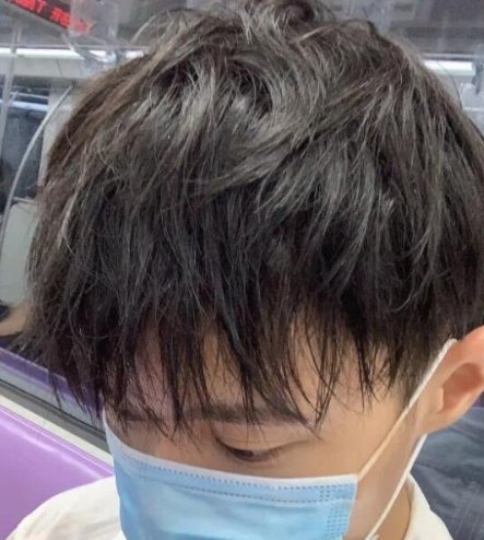 什么是摩根烫？