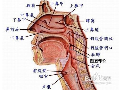 晚上睡觉打呼噜怎么办