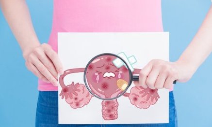 子宫内膜异位症什么原因引起