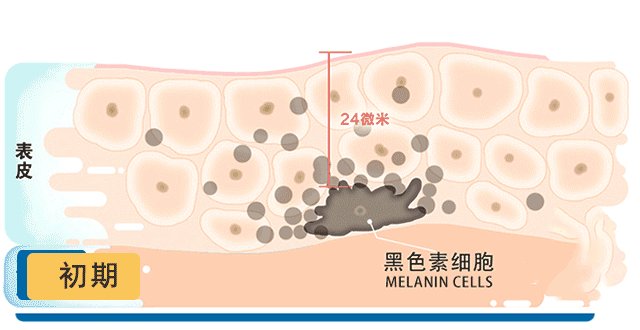 上海祛斑好的医院