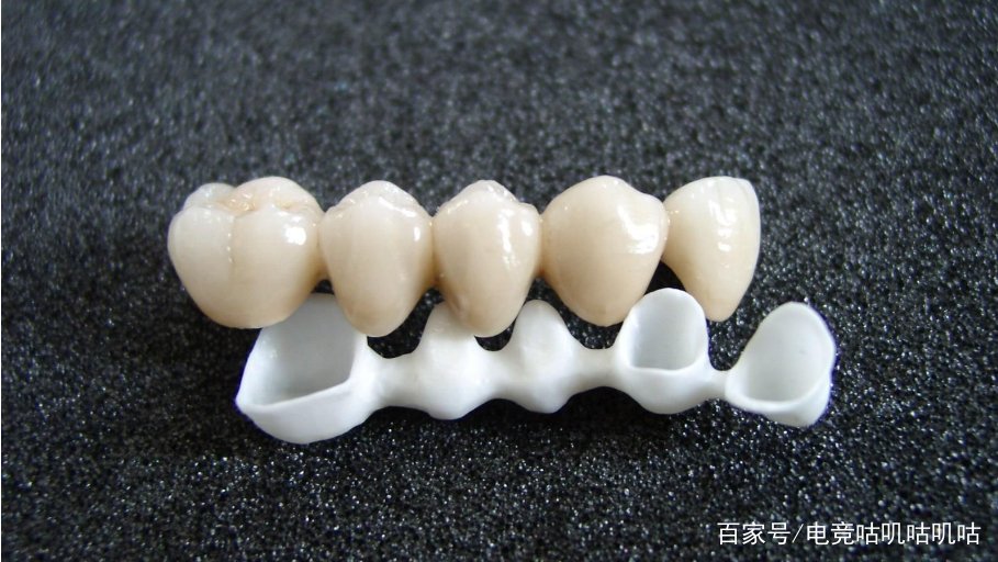 补一颗牙齿要多少钱啊？