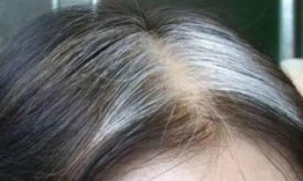 重庆女子花4万做“白发转黑”最终发现被骗，她该如何维权？