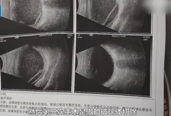 济南女子打网约车遇黑车被异物击中致失明！平台方默不作声，是想逃责吗？