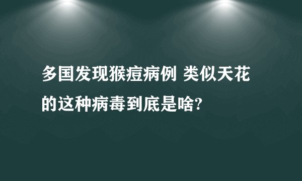 多国发现猴痘病例 类似天花的这种病毒到底是啥?