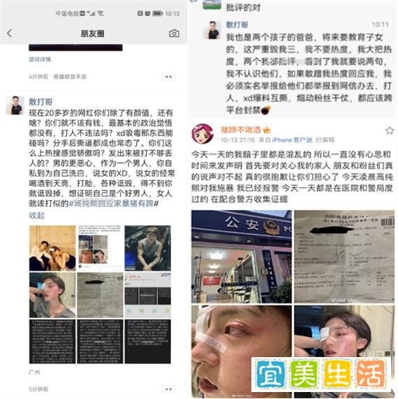 猪有蹄公布毒检证明没有xd，高纯熙向被家暴的猪有蹄道歉承认造谣