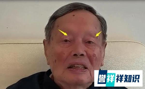 杨振宁近况引担忧，说话有气无力嘴巴脱皮严重缺水，网友喊话翁帆