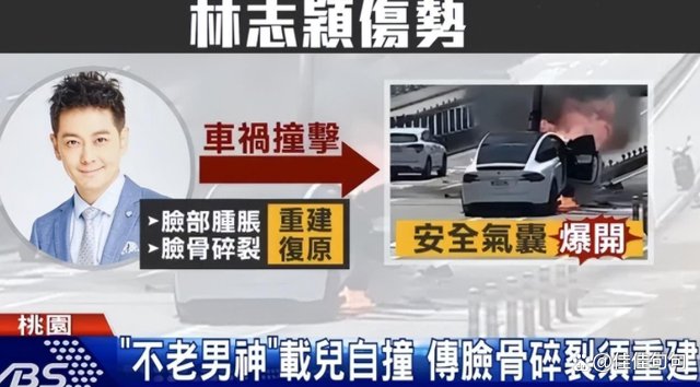 林志颖空降超话报平安,骨头复位漂亮,能恢复本来面貌吗?