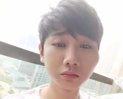 歌手汪苏泷摔倒后面部肿起，他究竟是如何摔倒的？