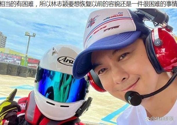 林志颖空降超话报平安,骨头复位漂亮,能恢复本来面貌吗?