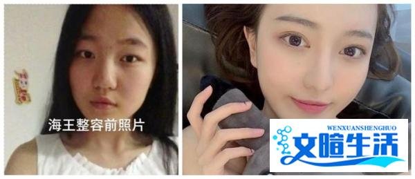 项思醒毕业旧照曝光，丑小鸭做了哪些整形项目摇身一变成为“女海王”？