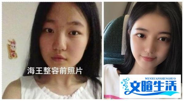 项思醒毕业旧照曝光，丑小鸭做了哪些整形项目摇身一变成为“女海王”？