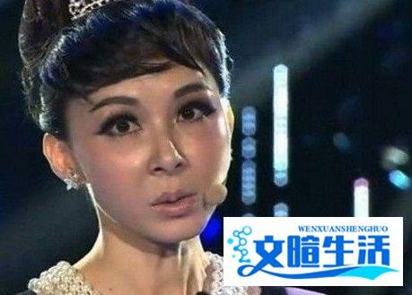 项思醒毕业旧照曝光，丑小鸭做了哪些整形项目摇身一变成为“女海王”？