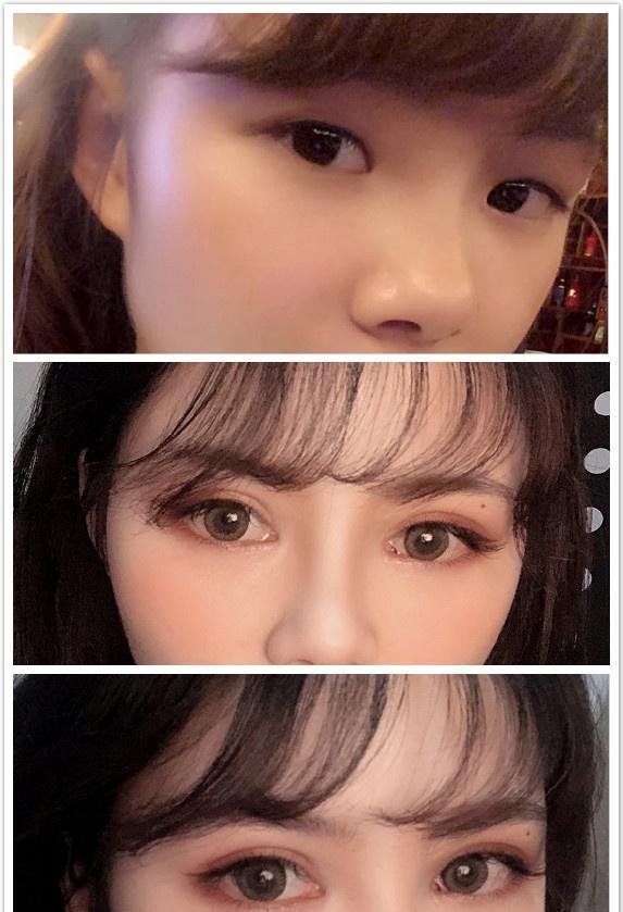 北京做双眼皮韩新鸣,姬东硕,吴焱秋,金奇龙哪个好?