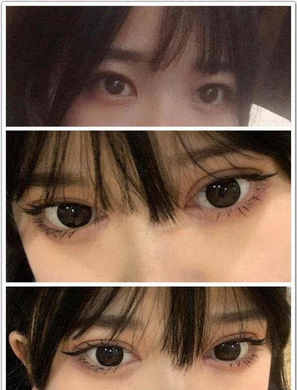 北京做双眼皮韩新鸣,姬东硕,吴焱秋,金奇龙哪个好?