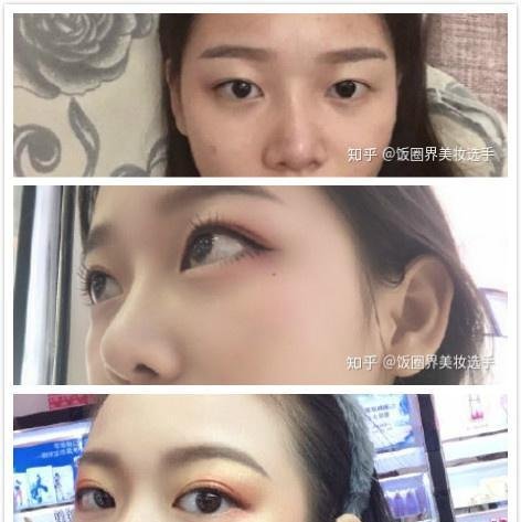 北京做双眼皮韩新鸣,姬东硕,吴焱秋,金奇龙哪个好?